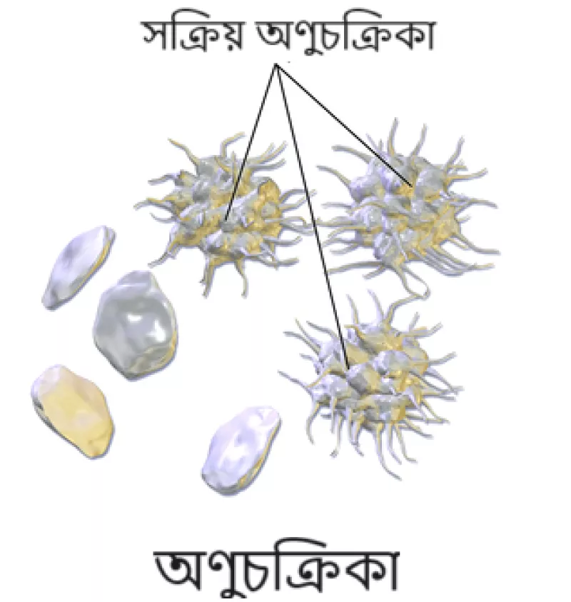 article