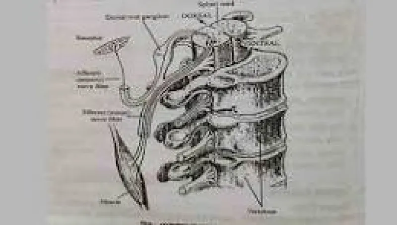 article
