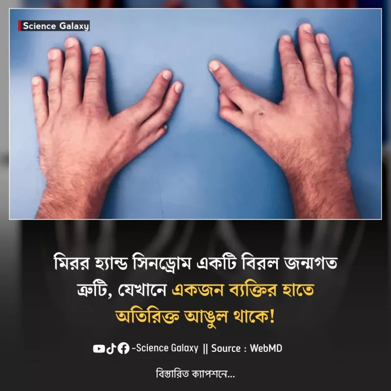article