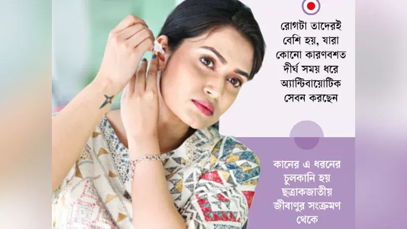 article